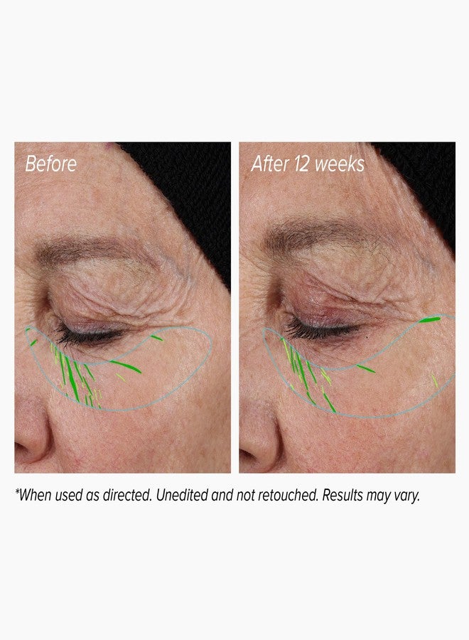 DRMTLGY Needle-less Growth Factor Serum for Face – Multi-Peptide & Hyaluronic Acid Facial Serum, Firming & Lifting, Skin Barrier Support & Wrinkle Care - Image 5